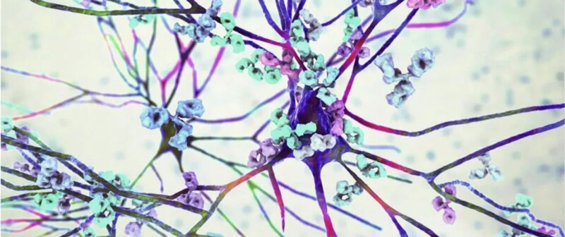 xcsports镇痛药效评价模型.jpg xcsports镇痛药效评价模型.jpg